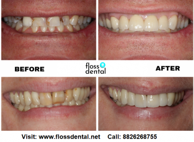 Cosmetic Dental Surgery