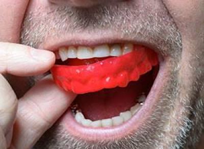 Customized Mouth Guard in Noida, Delhi NCR