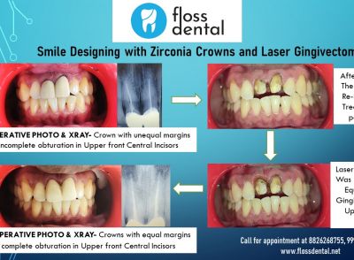 Get Yourself a Perfect Smile at Floss Dental Clinic