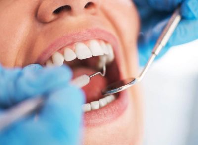 Most Common Dental Problems in India