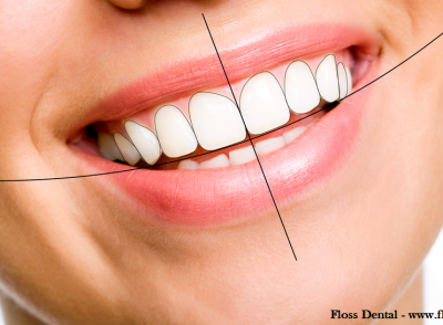 Smile Designing in Noida, Delhi NCR